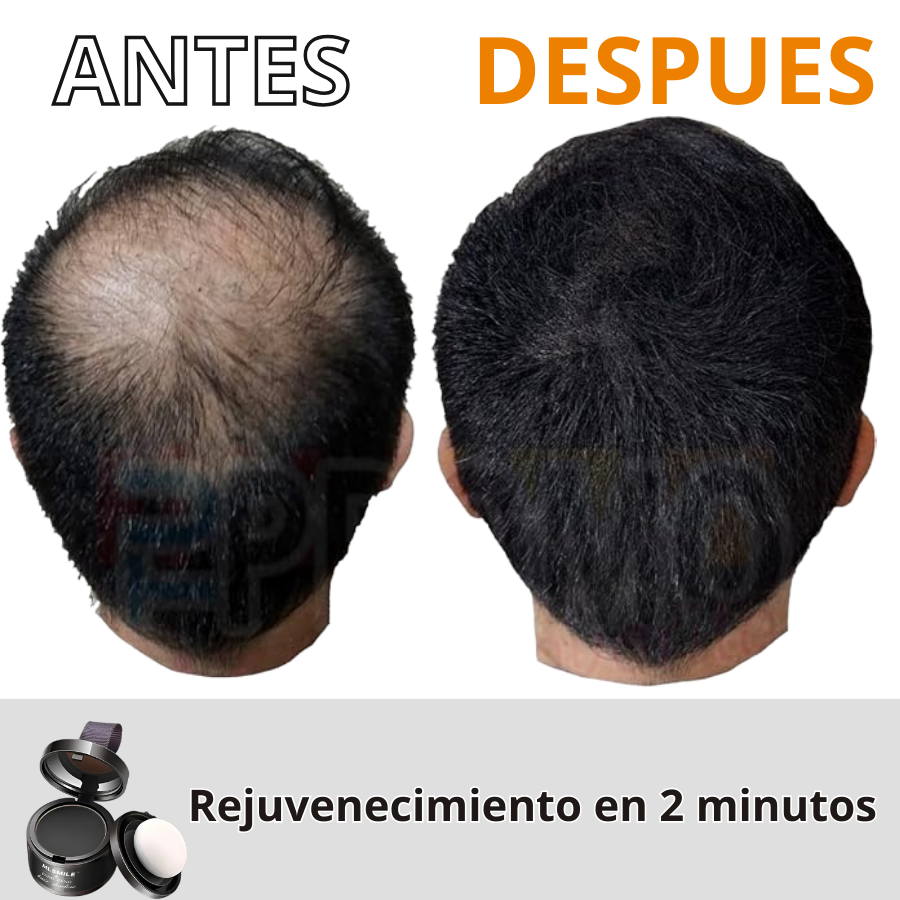 Henry Lux PRO