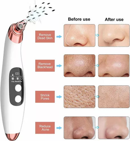 Derma Clear X